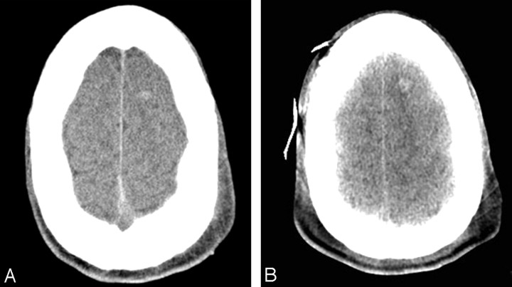 Fig 4.