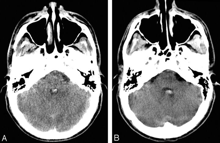 Fig 2.