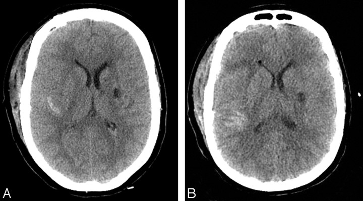 Fig 3.