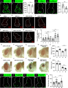 Figure 5—figure supplement 4.