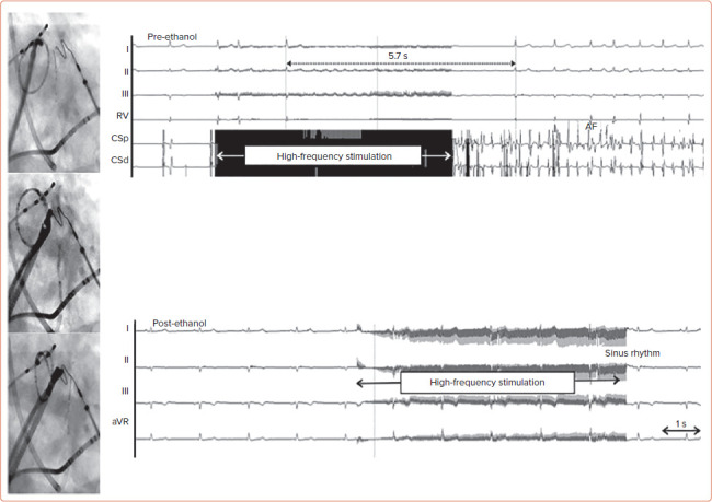 Figure 3: