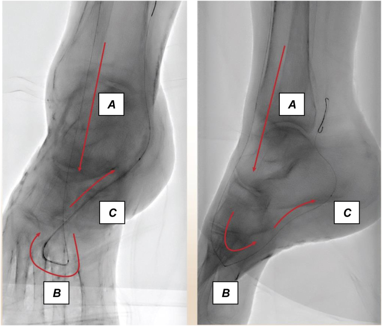 Fig 4