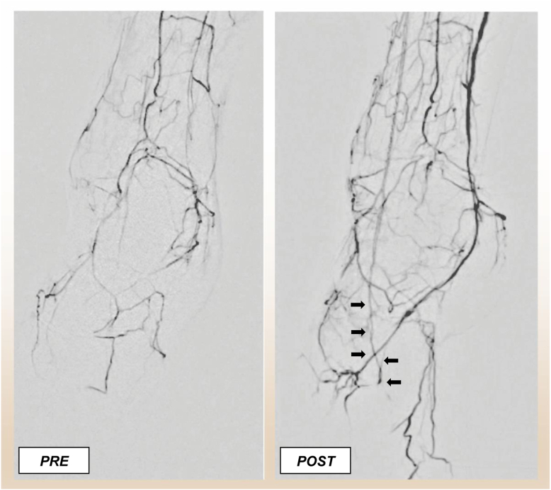 Fig 5