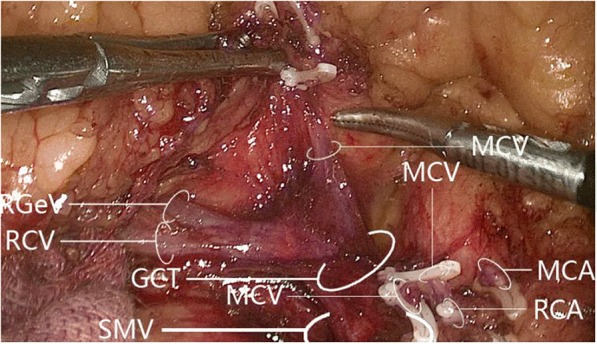 Fig. 12