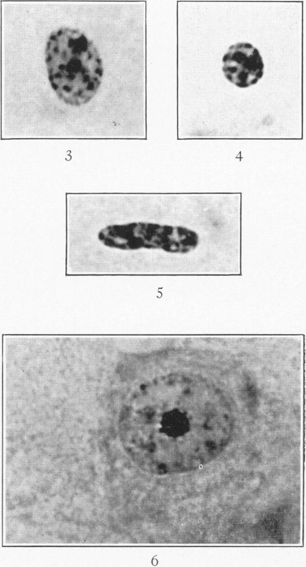 Figs. 3,4,5 and 6