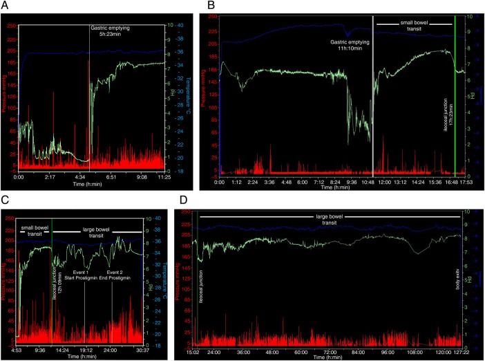 Figure 2