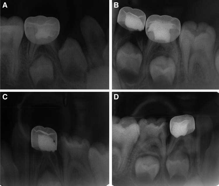 FIG 5.