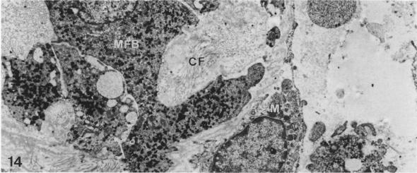 Figure 14