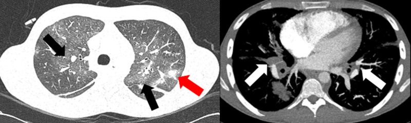 Figure 3.