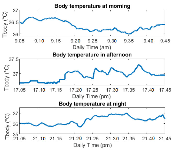 Figure 15