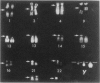 950