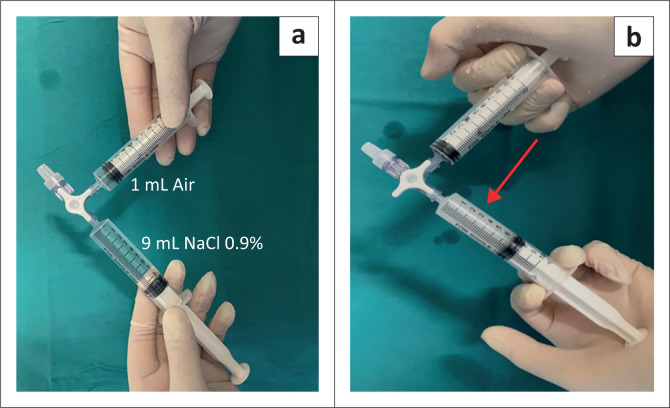 FIGURE 2