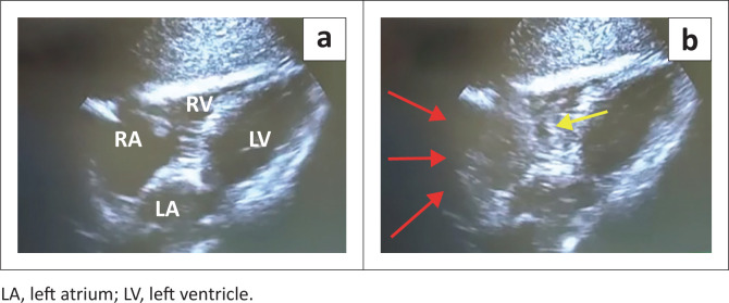 FIGURE 3