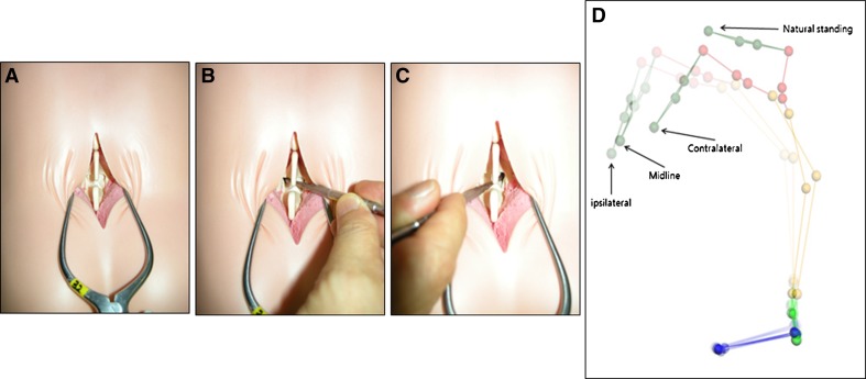 Fig. 1