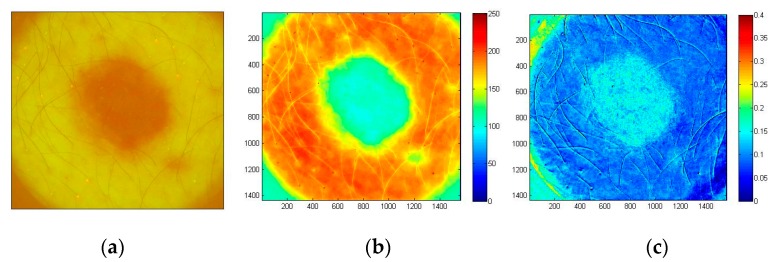 Figure 18