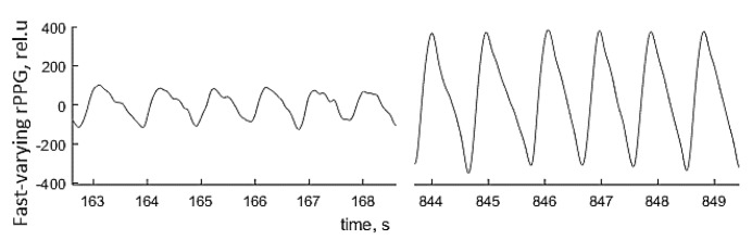 Figure 21