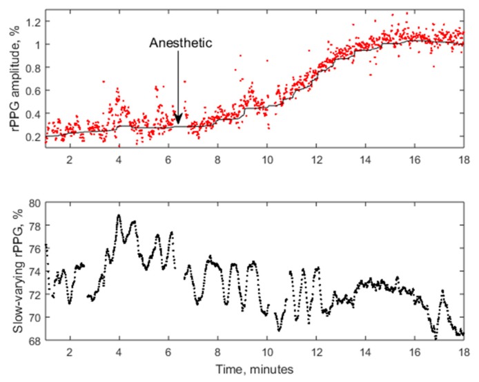 Figure 22