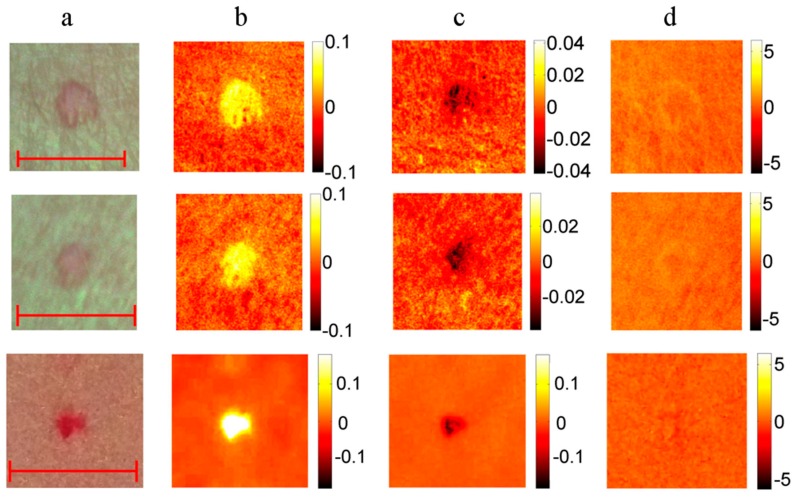 Figure 17