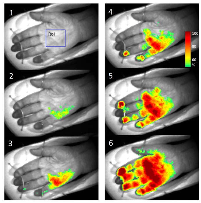 Figure 23