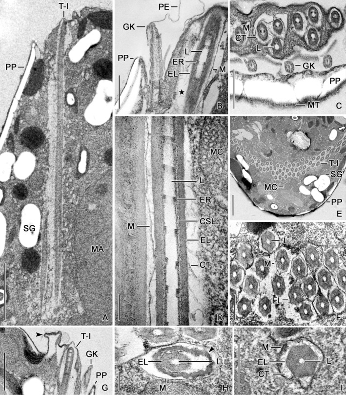 Trichite features contribute to the revision of the genus Strombidium ...