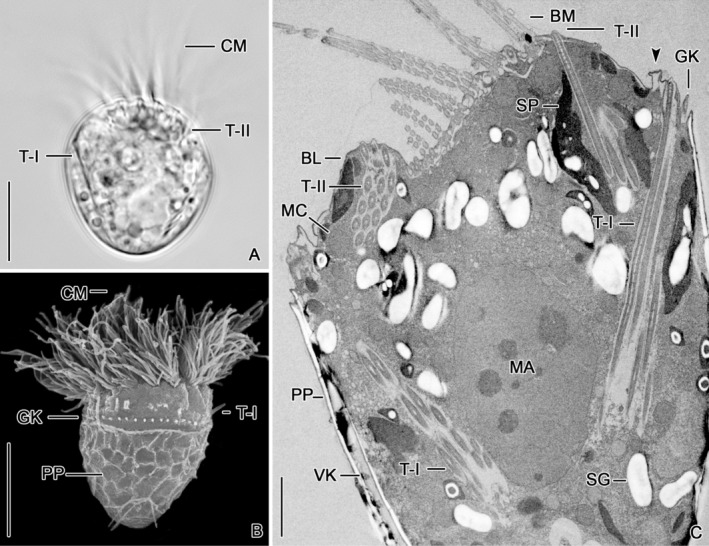 Trichite features contribute to the revision of the genus Strombidium ...