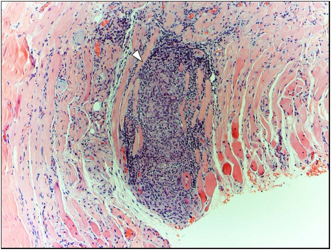 Fig. (2)