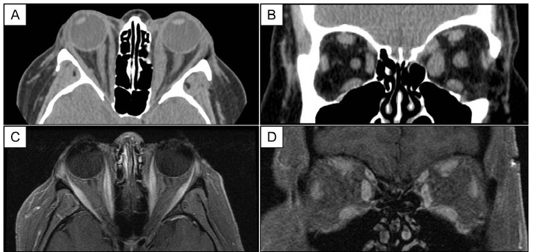 Fig. (1)