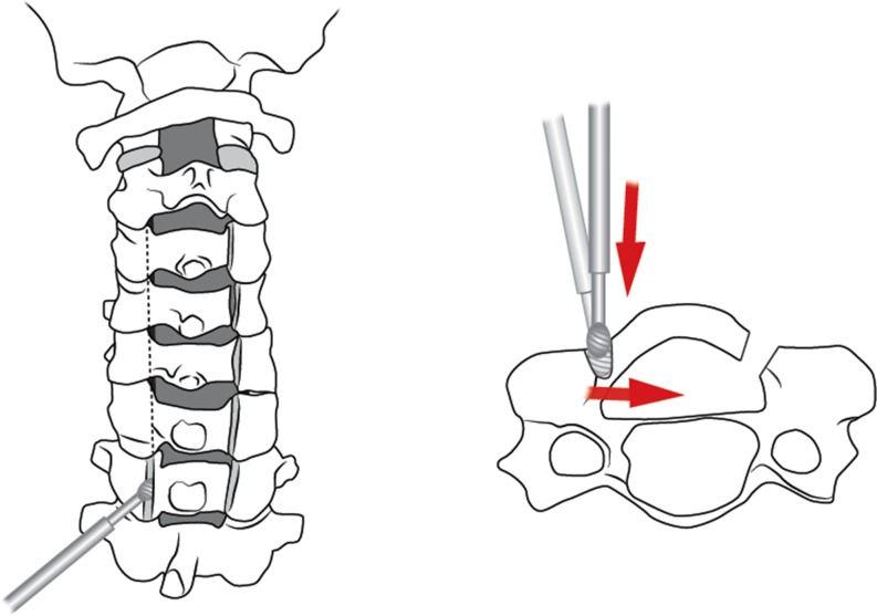 Fig. 3