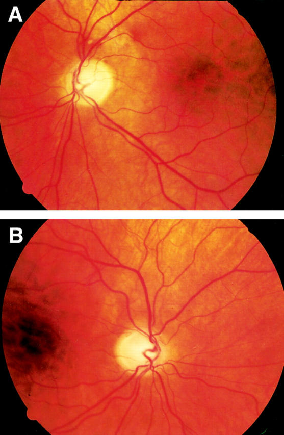 Figure 2  