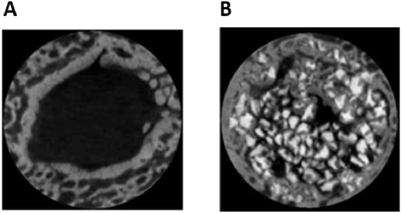 Fig. 14