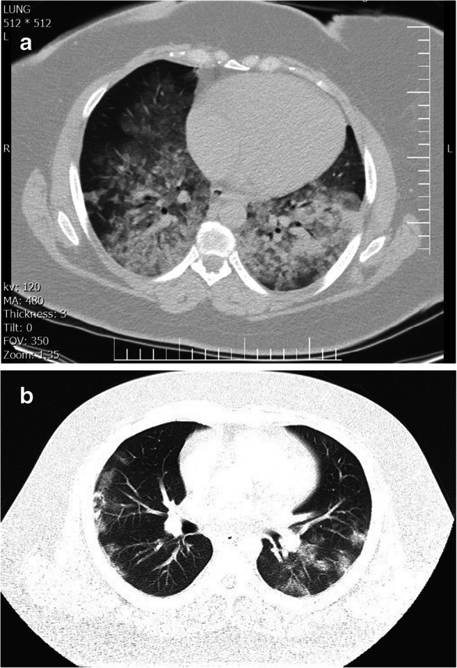 Fig. 1