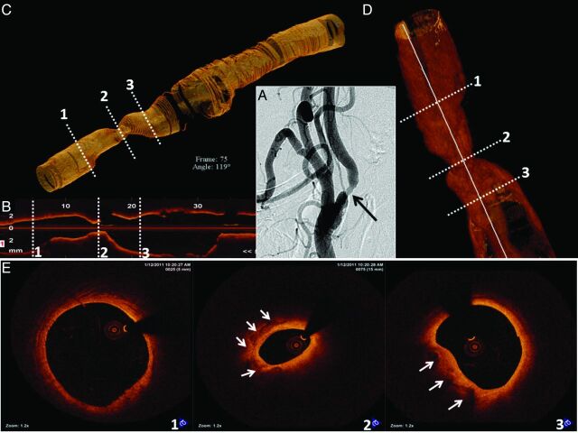 Fig 3.