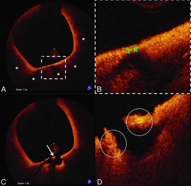 Fig 2.