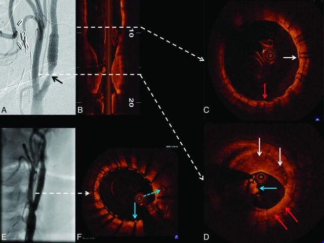 Fig 4.