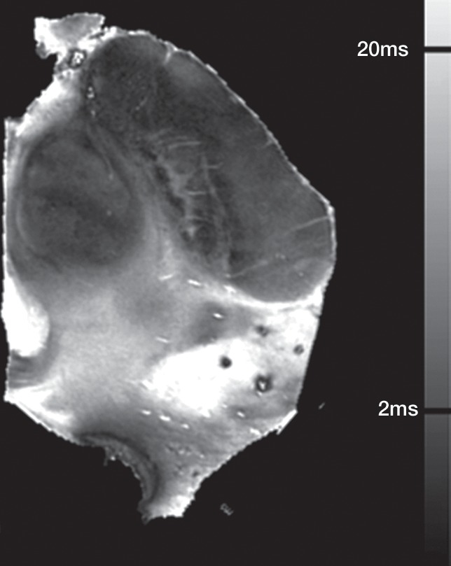 Figure 1b: