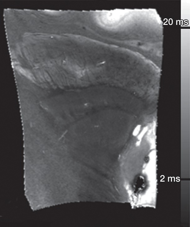 Figure 2b: