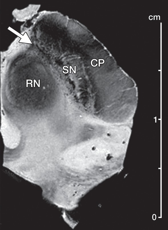 Figure 1a: