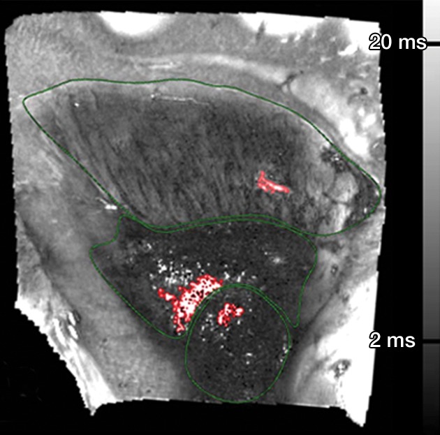 Figure 4b: