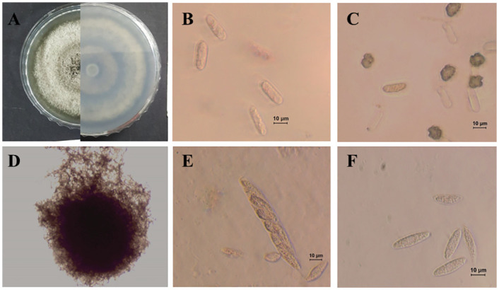 Fig 12