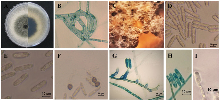 Fig 11