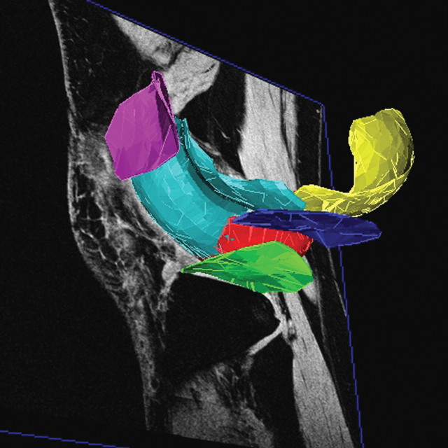 Figure 12a