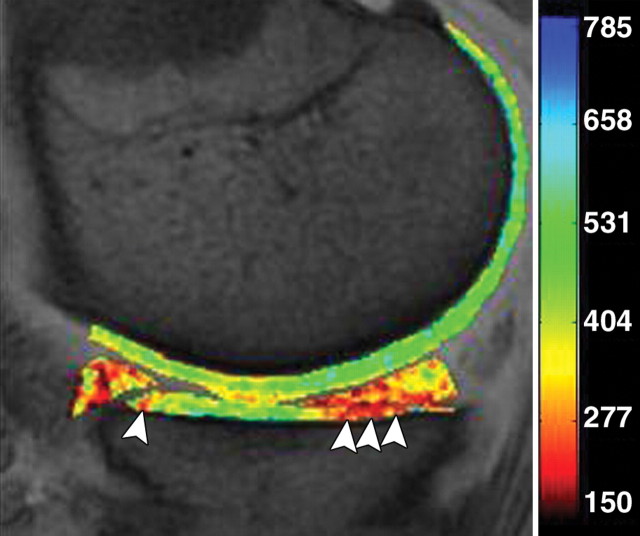 Figure 20b