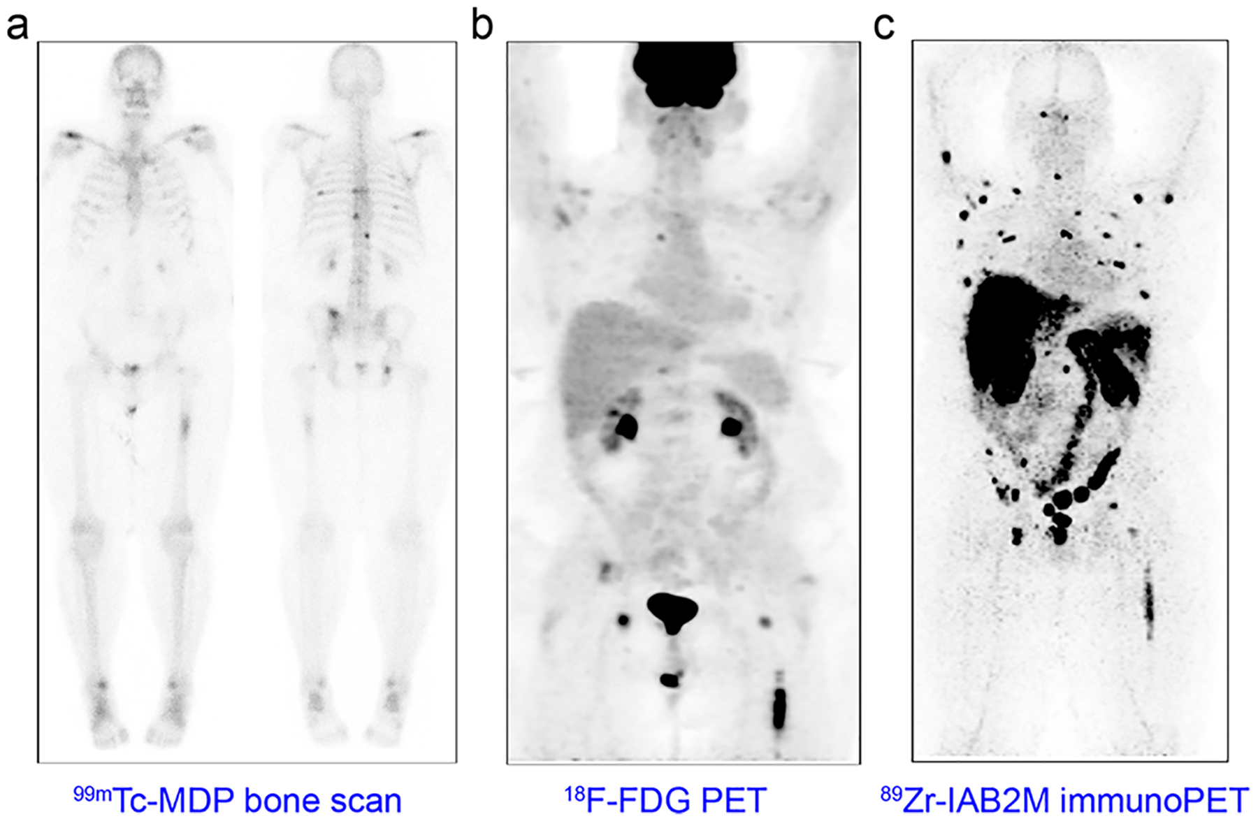 Immunopet concept design and applications pubmed