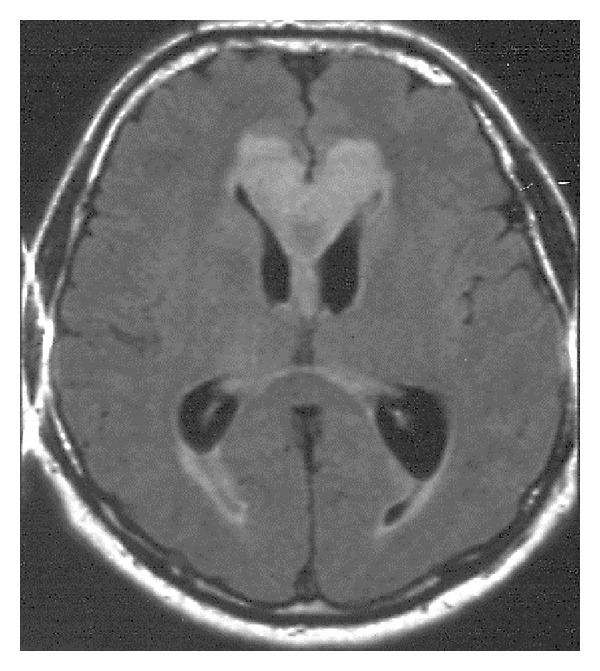 Figure 24