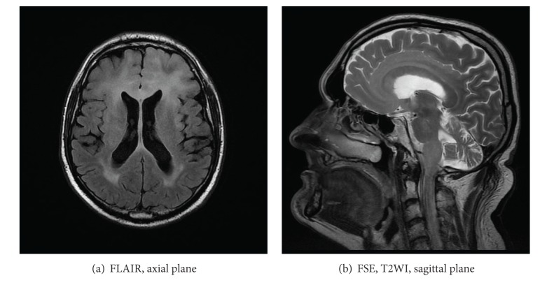 Figure 22