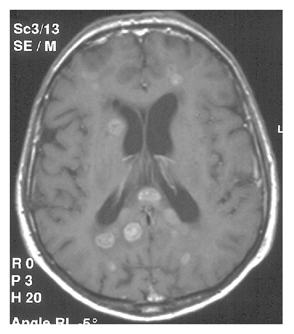 Figure 25