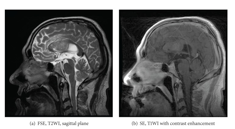 Figure 23