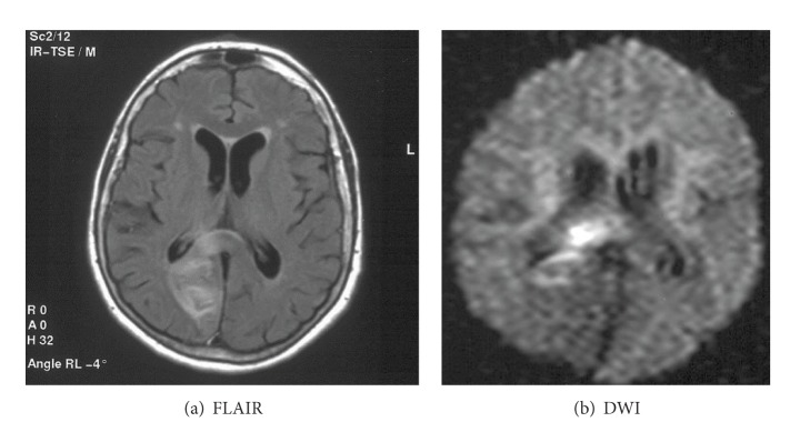 Figure 21