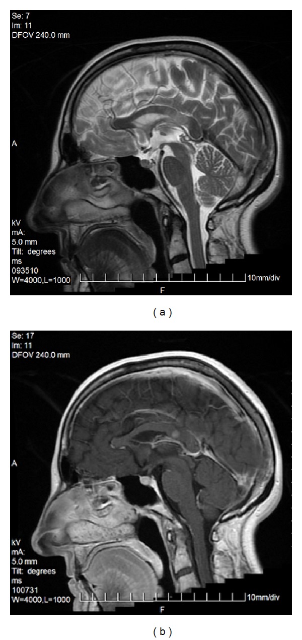 Figure 16