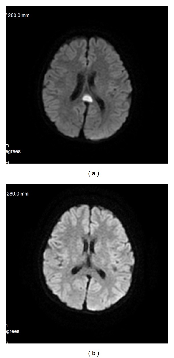 Figure 37